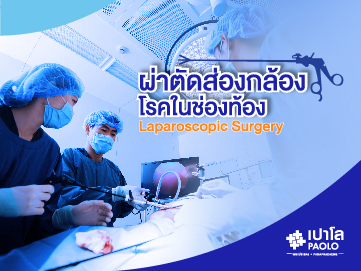 การผ่าตัดส่องกล้องช่องท้อง (Laparoscopic Surgery)
